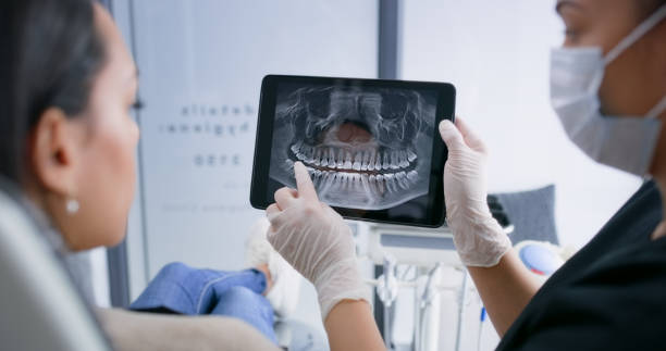 Licensed Tooth Extraction service in Bellevue, OH - Smile Center Dentistry
